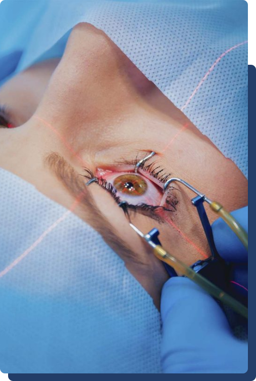 Cirurgia de Catarata