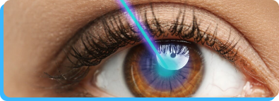 Cirurgia Refrativa