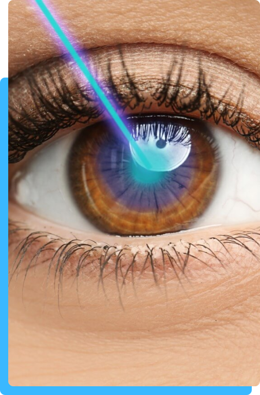 Cirurgia Refrativa